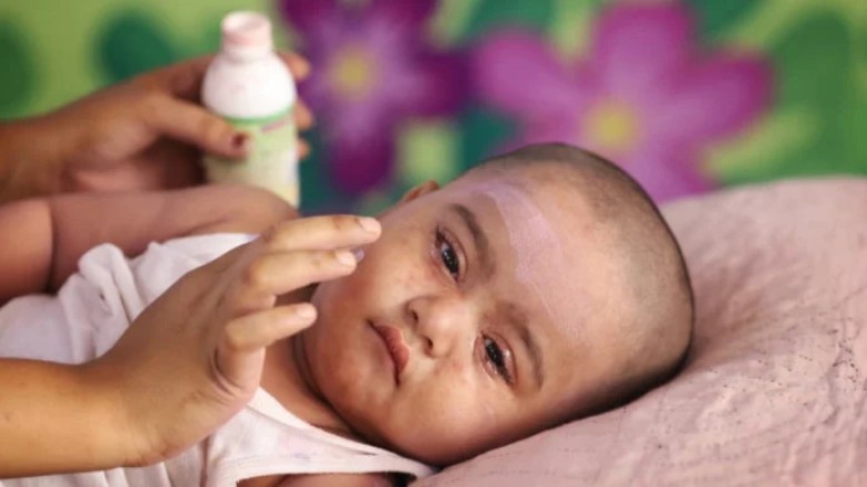 Emergency Measles-Rubella Vaccination Campaign Begins in DNCC, Targeting 500,000 Children