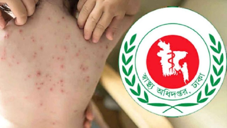 Malnutrition Alongside Low Vaccination Increasing Measles Risk, Child Deaths Rise